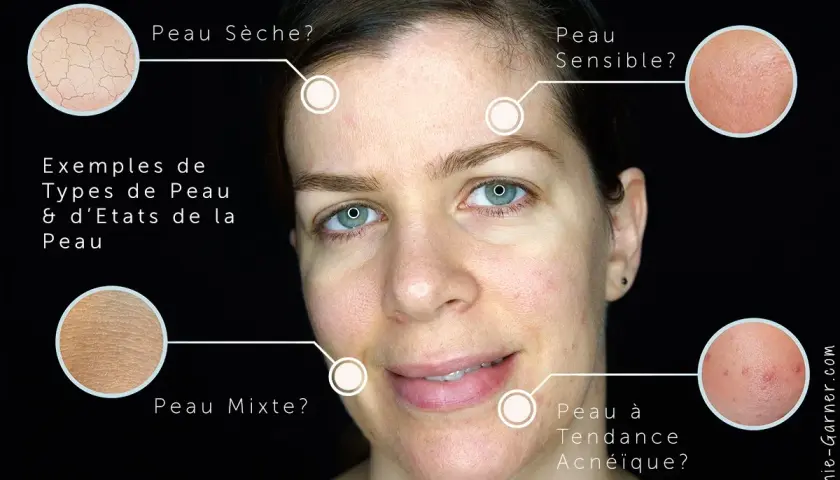 Visage montrant différents types de peau : sèche, sensible, mixte et à tendance acnéique. Comment savoir si on a la peau grasse ?
