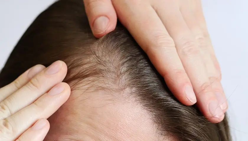 Manos revisando el cuero cabelludo y el cabello fino. Consejos para como cuidar tu pelo y mantenerlo fuerte.