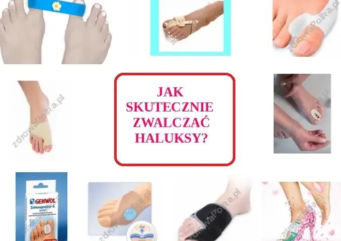 Skuteczna profilaktyka haluksów: Twój przewodnik do zdrowych stóp