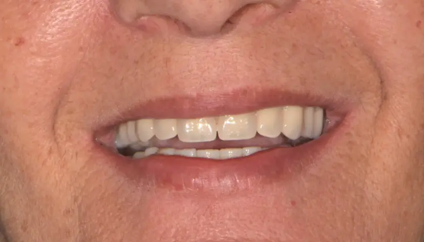 Un sorriso smagliante, ma attenzione: il tè macchia i denti.