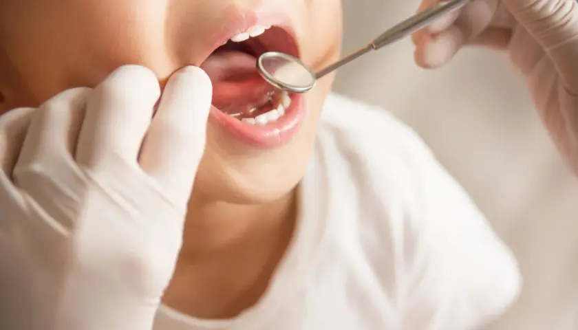 Bambino con bocca aperta esaminata da un dentista con specchietto. Si valuta la possibile ipomineralizzazione dello smalto.