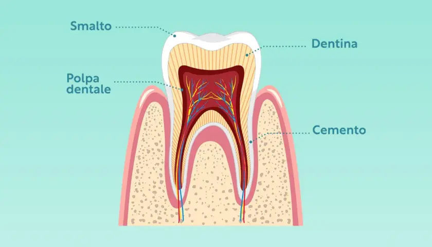 Sezione di un dente che mostra la struttura: smalto, dentina, polpa dentale e cemento.