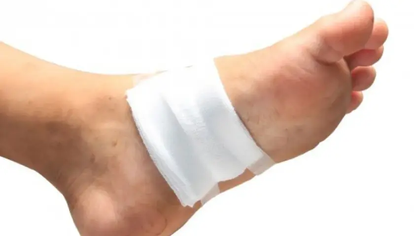 Un pansement blanc est appliqué sur le dessus du pied, suggérant la question : faut il mettre un pansement sur une brûlure ?
