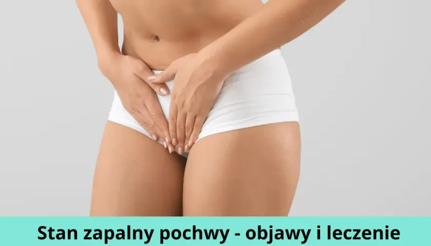 Stan zapalny pochwy: 5 głównych przyczyn i skuteczne leczenie