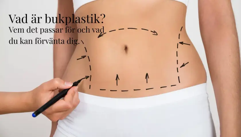 En hand markerar med penna en linje runt en mage, som visar området för en bukplastik. Texten frågar "Vad är bukplastik?".