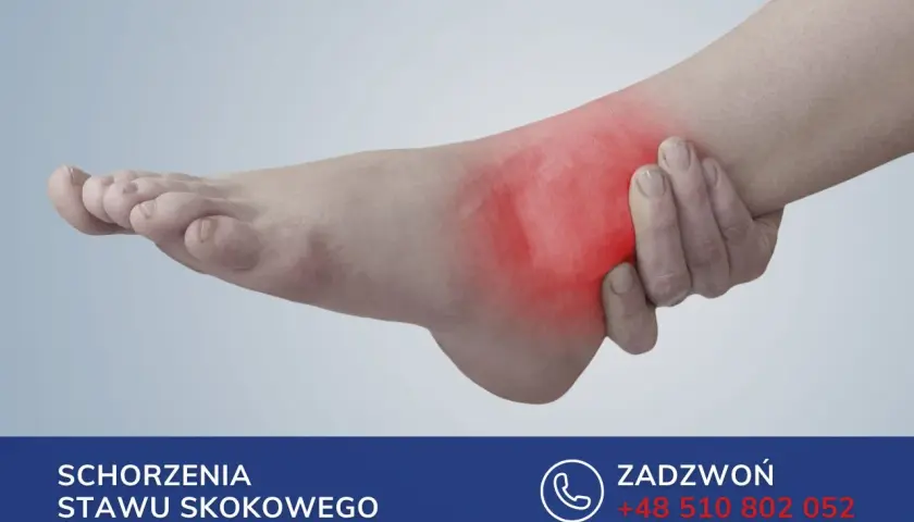 Ból stopy i kostki, zaczerwienienie sugerujące zapalenie pochewki ścięgna. Skontaktuj się w celu leczenia schorzeń stawu skokowego.