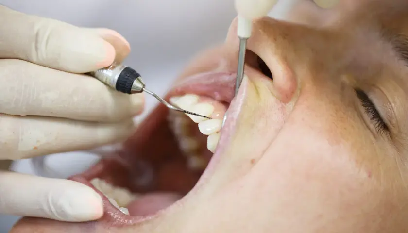 Un periodoncista que es, examina la salud de las encías y dientes con instrumental dental.