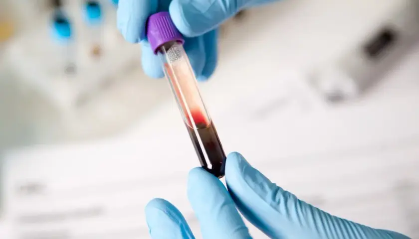 Rękawiczki z niebieskiej lateksowej rękawiczki trzymają probówkę z krwią. Morfologia cena badania.