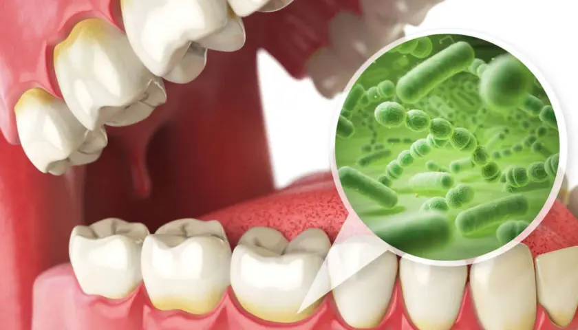 Ingrandimento del microbiota orale: batteri verdi su sfondo verde, con denti ingialliti in primo piano.