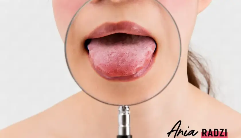 Powiększony pypeć na języku pod lupą. Czy to coś poważnego?