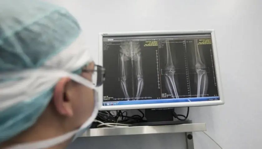 Ortopeda w masce i czepku analizuje na monitorze zdjęcia RTG kolan i kości udowych.