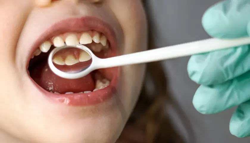 Bocca di un neonato con ciuccio, mentre un dentista esamina i suoi dentini con uno specchietto.