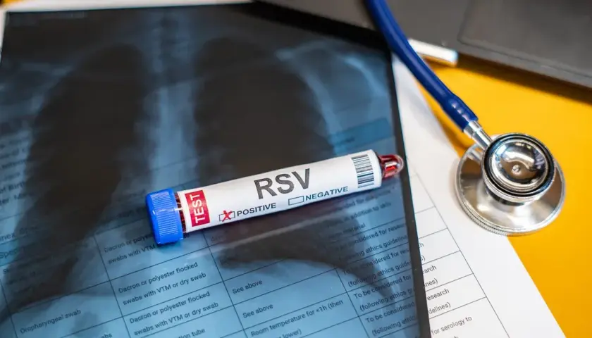 Test na wirus RSV z pozytywnym wynikiem, obok stetoskop i zdjęcie rentgenowskie klatki piersiowej.
