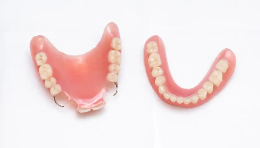 Due protesi dentali, una con ganci metallici, mostrano la soluzione di una dentiera fissa per un sorriso completo.
