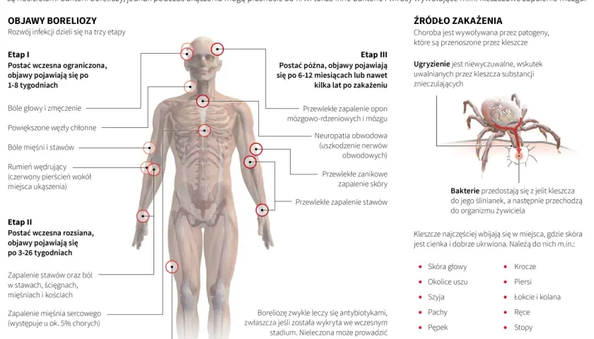 Borelioza objawy po latach - jak nieleczona choroba wpływa na zdrowie?