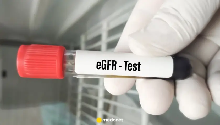 Rękawiczka trzyma probówkę z napisem "eGFR - Test". To badanie ocenia funkcję nerek.