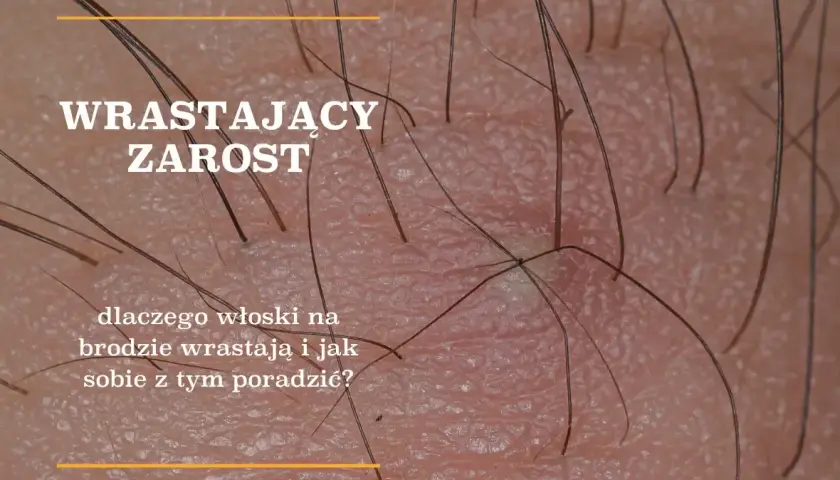 Kiedy rośnie zarost? Wiek, etapy i indywidualny rozwój
