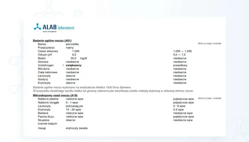 Ile siku do badania moczu? Kluczowe informacje o czasie i przygotowaniu