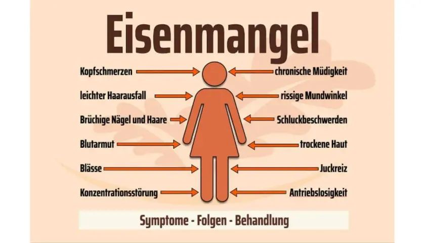 Eisenmangel kann zu Kopfschmerzen, Müdigkeit, Haarausfall und trockener Haut führen. Die Grafik zeigt Symptome wie Blutarmut und Konzentrationsstörungen.
