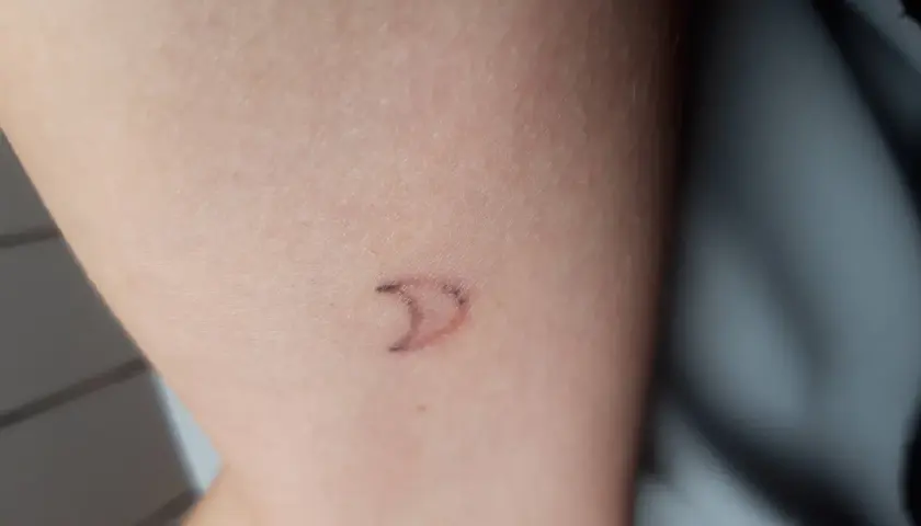 Wypadanie tuszu z tatuażu: Kiedy to norma, a kiedy problem?