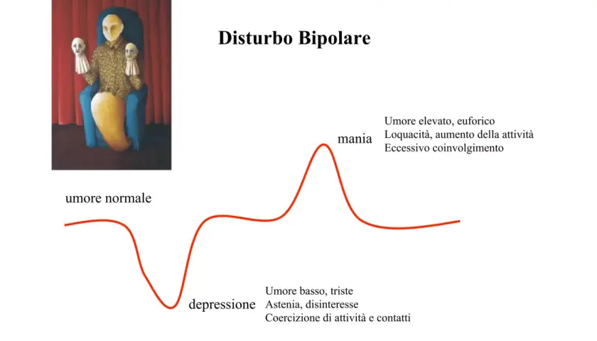 Illustrazione del disturbo bipolare tipo 1: un grafico mostra fluttuazioni dell'umore tra mania ed euforia e depressione, con un'immagine simbolica di una figura seduta con maschere.