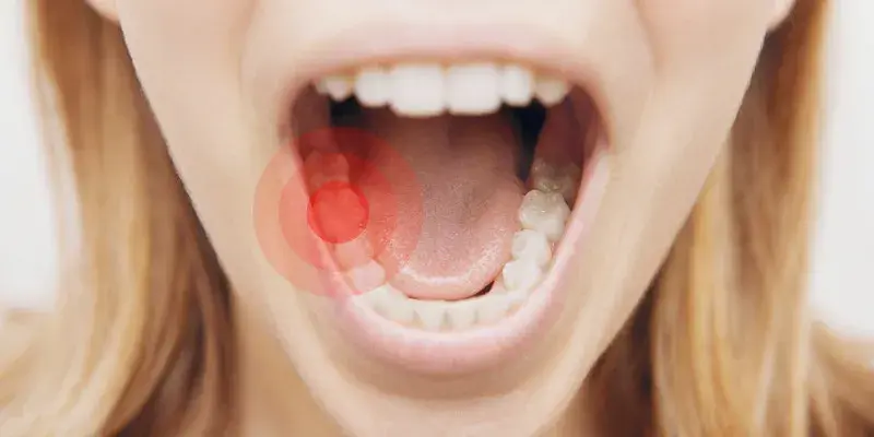 Ile trwa ból zęba? Przyczyny, czas trwania i kiedy do dentysty