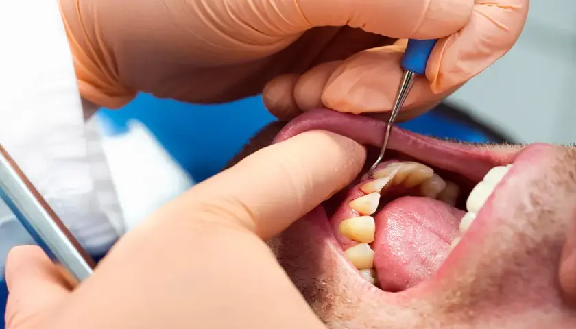 Dentista esamina i denti per valutare la parodontite, cercando i migliori rimedi per la salute gengivale.