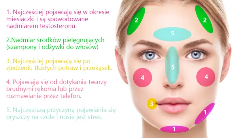 Pryszcze na policzkach: Co oznaczają i jak skutecznie walczyć?