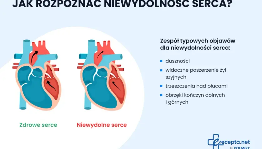 Porównanie zdrowego i niewydolnego serca. Objawy niewydolności serca: duszności, obrzęki, trzeszczenia nad płucami.