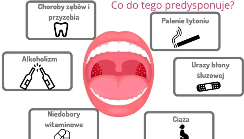 Zapalenie jamy ustnej: Szybkie sposoby, leki i kiedy iść do lekarza