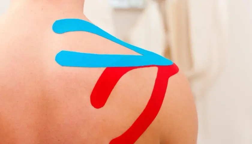 Kinesiotaping na plecach wspierający ćwiczenia na odstające łopatki. Kolory niebieski i czerwony.