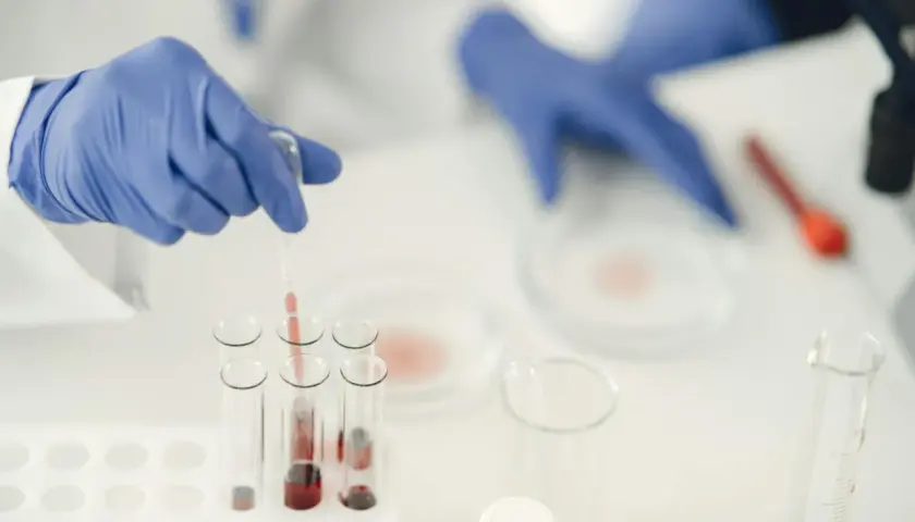 Badacz w niebieskich rękawiczkach pobiera próbkę krwi do analizy. Może to być związane z diagnostyką mykoplazma objawy.