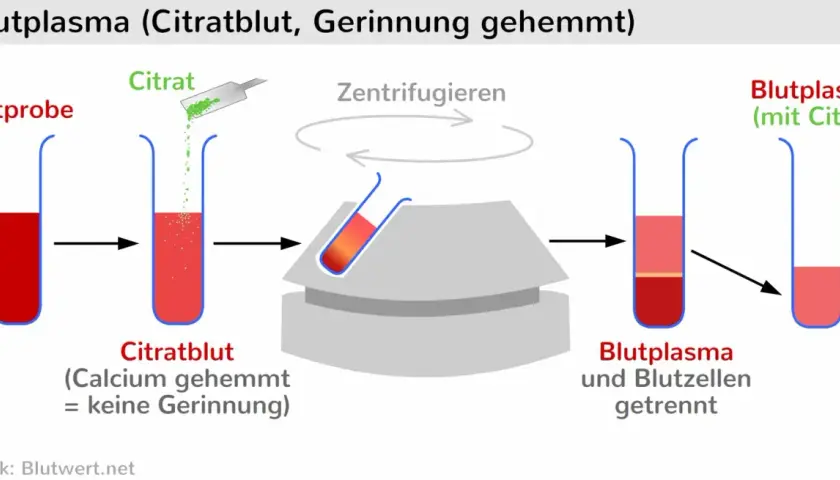 Blutprobe wird mit Citrat versetzt, zentrifugiert, um Blutplasma und Blutzellen zu trennen. Ein schneller Wert für die Analyse.