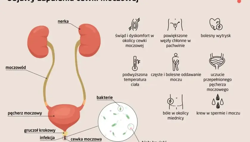 Objawy zapalenia cewki moczowej: pieczenie, ból, gorączka, krew w moczu, bolesny wytrysk. Infekcja bakteryjna cewki moczowej.