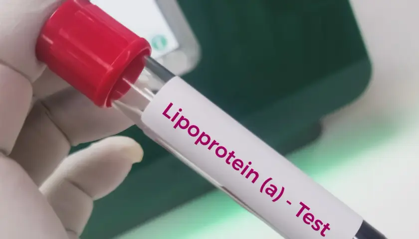 Rękawiczka laboratoryjna trzyma probówkę z napisem "Lipoprotein (a) - Test". To badanie ocenia poziom lipoproteiny (a), ważnego markera ryzyka sercowo-naczyniowego.