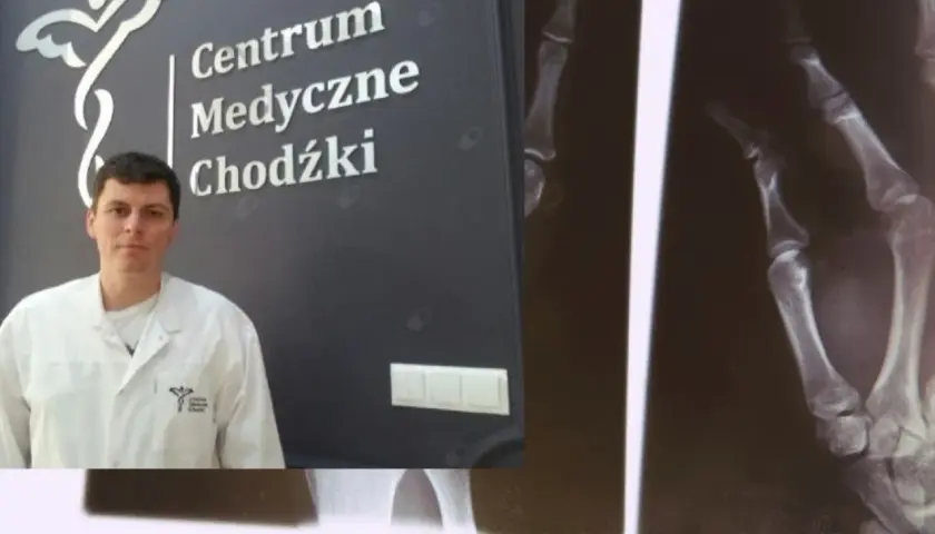 Lekarz w białym fartuchu na tle logo Centrum Medyczne Chodźki i zdjęcia RTG dłoni.