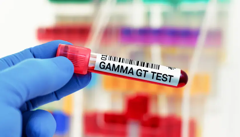 Rękawiczka w niebieskiej rękawicy trzyma probówkę z napisem "GAMMA GT TEST". Wynik badania jest w normie.