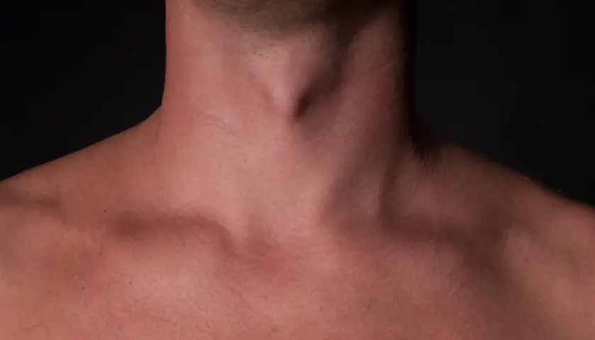 Jabłko Adama u mężczyzn - poznaj prawdę o tej męskiej cesze anatomicznej