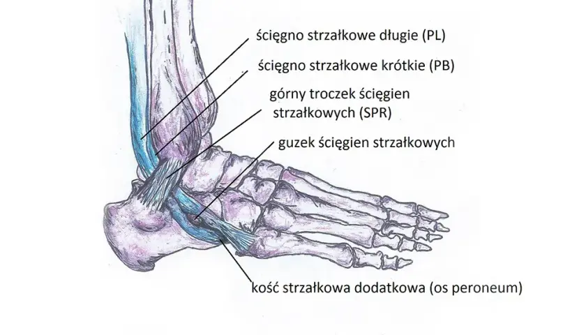 Naciągnięcie ścięgna w stopie: rozpoznaj objawy i zacznij leczenie