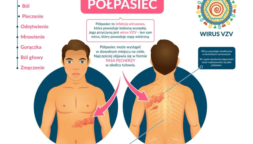 Najczęstsze objawy półpaśca - poznaj pierwsze niepokojące sygnały choroby