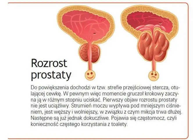 Skutki uboczne leków na prostatę: jak unikać zagrożeń i monitorować zdrowie