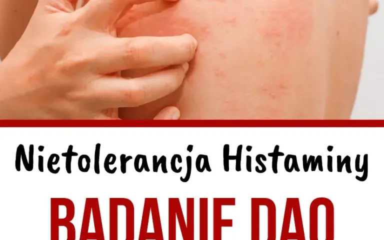 Niedobór DAO: jakie są objawy i jak diagnozować ten stan?