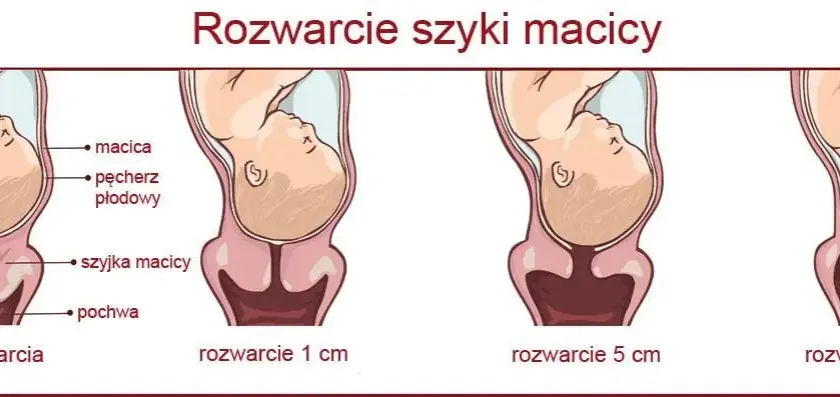 Rozwarcie na 2 palce: ile cm to jest i co oznacza w porodzie?