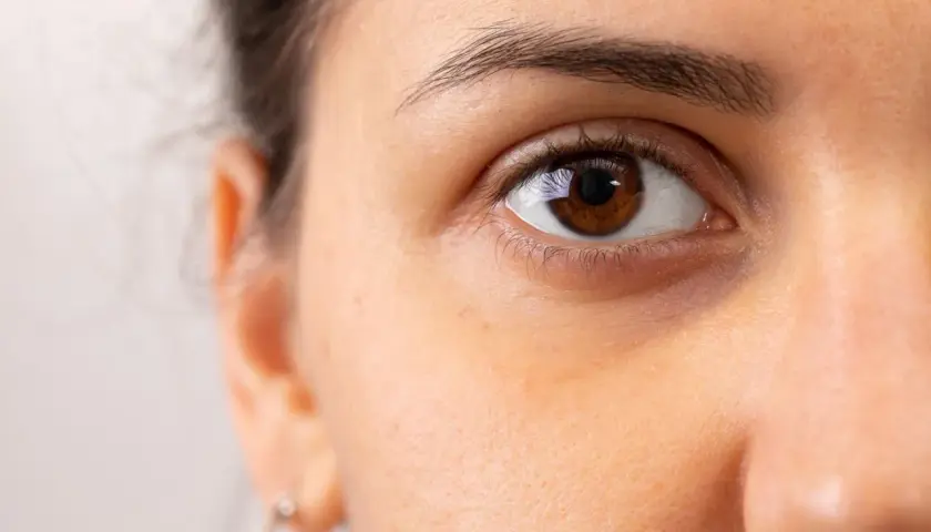 Nahaufnahme eines braunen Auges mit sichtbaren Schatten, die dunkel zwischen Nase und Auge liegen.