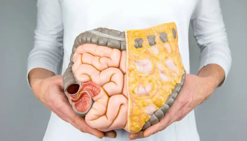 Lactobacillus plantarum 299v w terapii SIBO: Efekty i zastosowanie