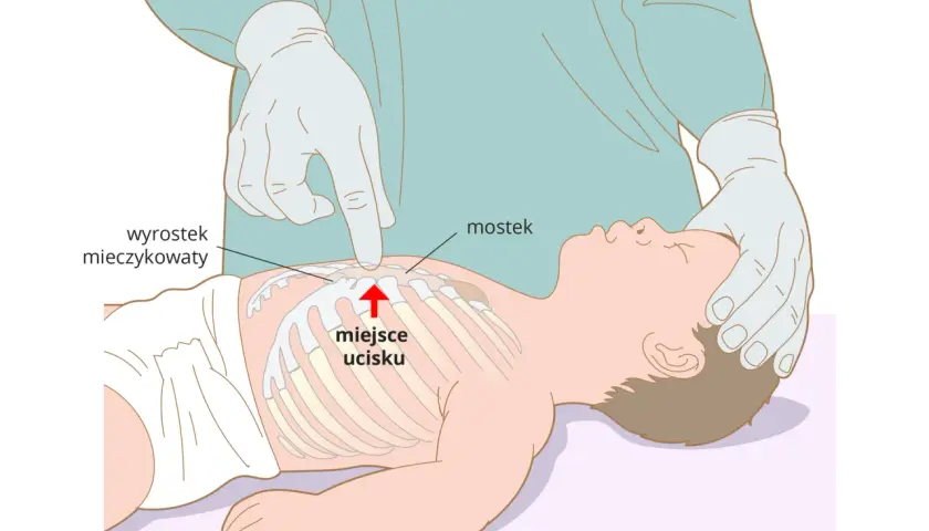 Masaż serca gdzie uciskać: Kluczowe miejsca, które mogą uratować życie