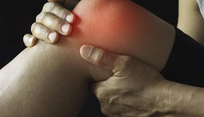 Schmerzendes Knie mit roter Hitze, die auf eine Schleimbeutelentzündung Knie Symptome hinweist. Hände umfassen das Gelenk.