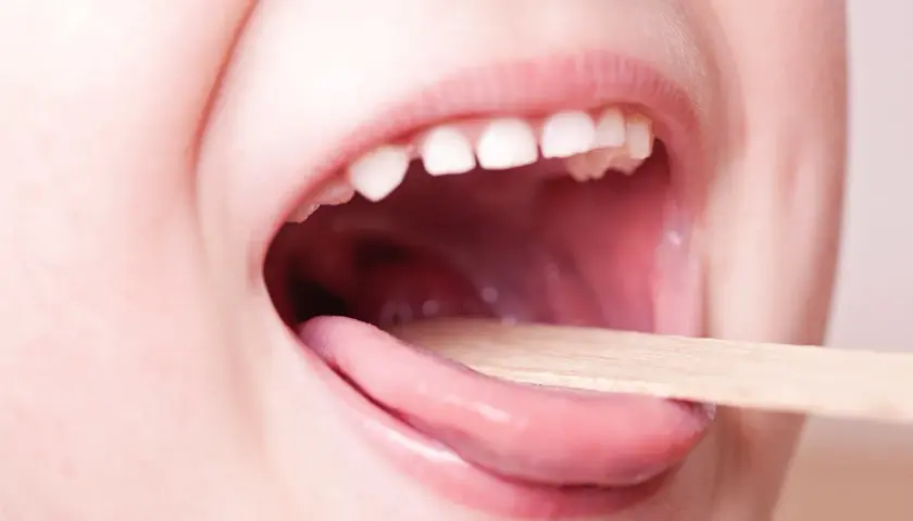 Bocca di bambino aperta con linguetta di legno per controllare la gola. Informazioni sulla faringite bambini quanto dura.