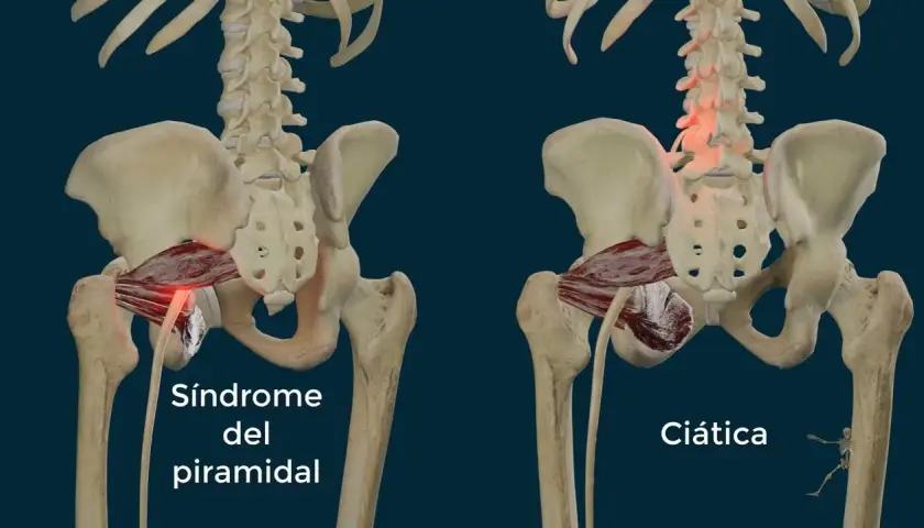 Músculos piramidales: diferencias clave entre piriforme y piramidal