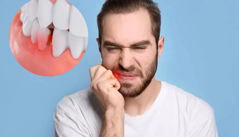 Uomo con dolore alla guancia, immagine ingrandita di un dente con gengiva infiammata. Sintomi di infezione dente sotto capsula.